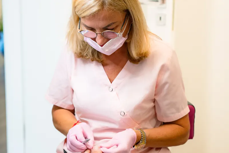 Nagelspangenbehandlung – Ablauf der Behandlung in der Praxis PodoTrend